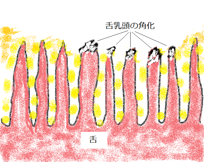 舌乳頭の角化の図