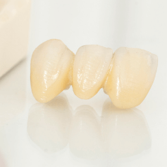 ポーセレンの歯