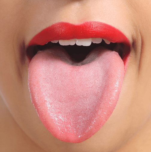 正常な舌の色