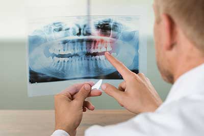 Close-up Of Male Doctor Pointing At Teeth X-ray