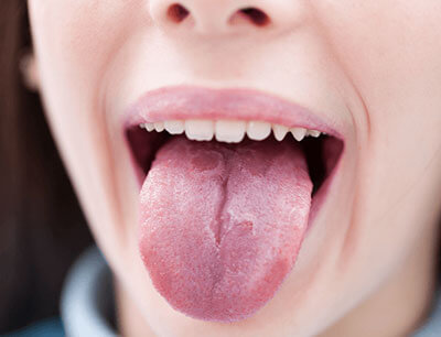 舌の溝