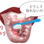 舌磨きはコットンが効果的！？