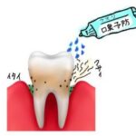 歯周病で口臭がひどい！臭いを消す方法