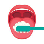 舌が白いと口臭になる！舌磨きのポイントは粘膜を傷つけないこと
