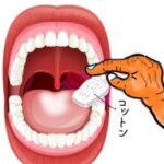 舌苔取り方❘コットンで拭く