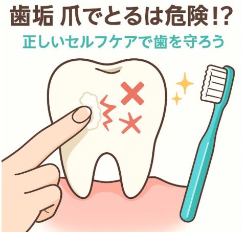 歯垢を爪で取る危険性と正しいセルフケアを訴えるアニメ風イラスト。大きな歯の表面を指の爪でこする場面に赤い×印やリスクマーク、右側に輝く歯ブラシ。上部には「歯垢 爪でとるは危険！？正しいセルフケアで歯を守ろう」という日本語キャッチコピー。歯垢除去の注意点と歯ブラシケアの重要性を分かりやすく示す画像。