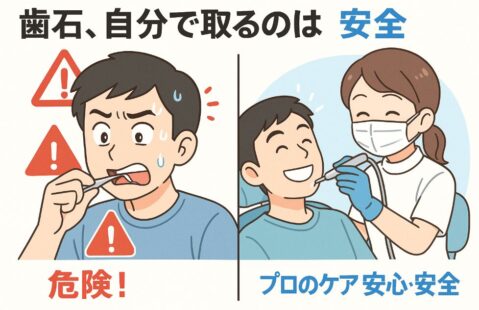 自分で歯石を取る危険性と、歯科医院で安全に除去する安心感を、左右で対比したアニメ風の解説イラストです。