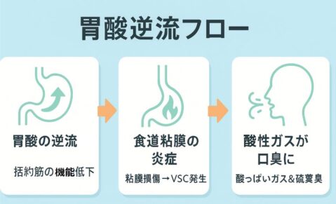 胃酸逆流フロー図解