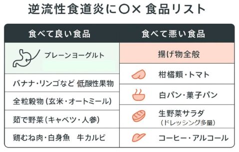 逆流性食道炎に◎× 食品リスト
