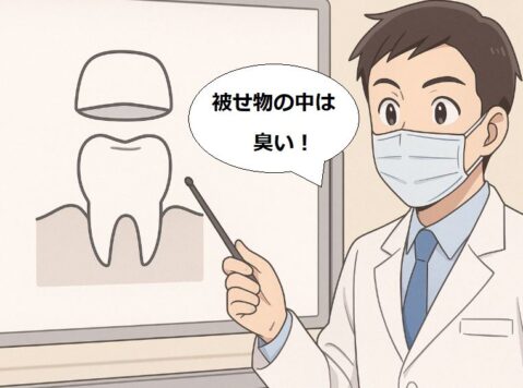 「被せ物が臭い原因」を説明している歯科医師のイラスト