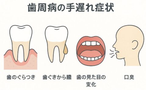 歯周病手遅れ症状の図解