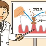 口臭を治すフロスのやり方を説明する歯医者さんのイラスト