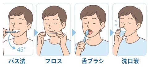 バス法・フロス・舌ブラシ・洗口液の4ステップセルフケアを示すイラスト