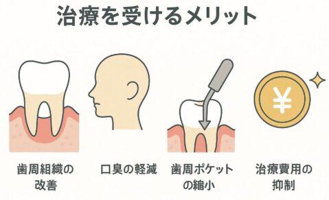 歯周病治療を受けるメリットのイラスト