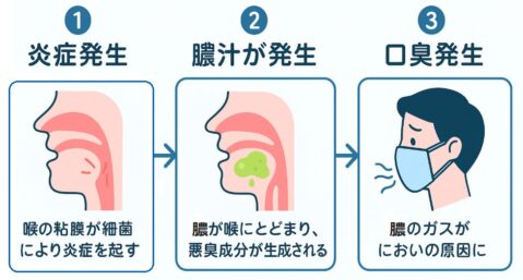 膿汁プロセス図