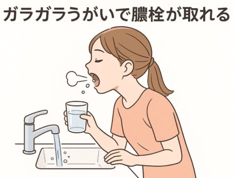洗面所でガラガラうがいをして膿栓が出る瞬間を描いたアニメ調イラスト。日本人女性がコップの水をガラガラとうがいし、小さな白い膿栓が口元から出てくる様子を清潔感のある色使いで表現。画像上部に「ガラガラうがいで膿栓が取れる」という日本語ラベル付き。