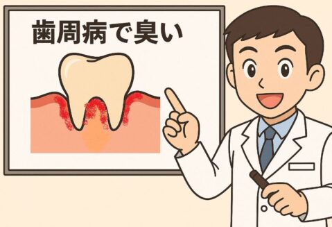 歯周病が原因の口臭について説明する歯医者さんのイラスト