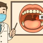大量にでてきた膿栓の原因と対策を説明する医師