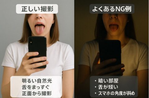 舌診断アプリ使用時の撮影NG説明画像