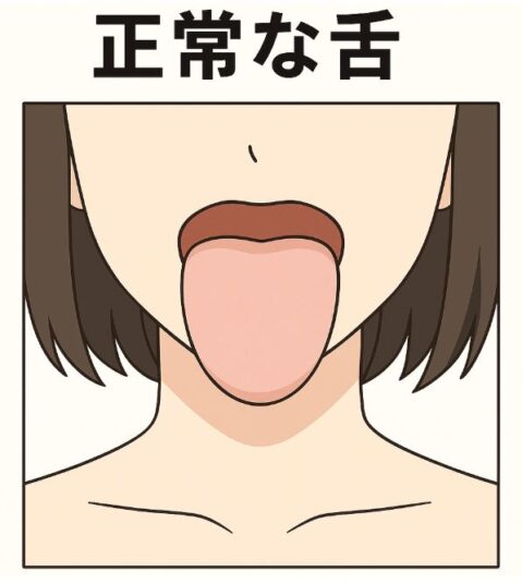 肝炎の舌と比較するための「正常な舌」のイラスト