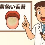 黄色舌苔について説明する歯医者さんのイラスト