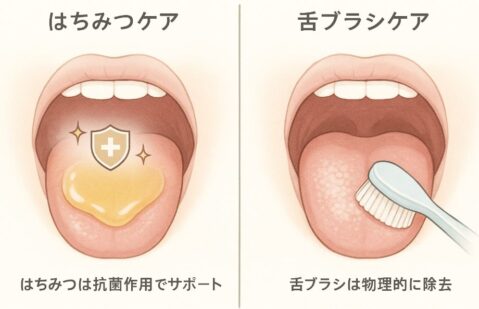 舌苔除去法：はちみつケアと舌ブラシケアの違い