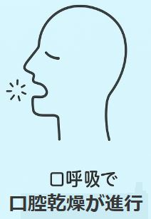 口呼吸