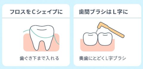 歯周病ケアのためのフロスと歯間ブラシの使い方図解