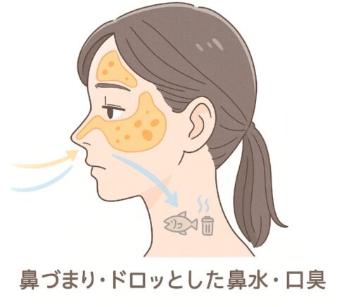 副鼻腔の正しい部位（額・鼻・頬）を黄色で示し、口や喉に臭いの矢印と魚・ゴミ箱アイコン、「鼻づまり・ドロッとした鼻水・口臭」の日本語ラベルがある医療系アニメ風イラスト