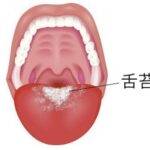 中々取れない舌苔を除去する方法を説明するための図