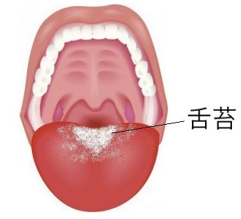 中々取れない舌苔を除去する方法を説明するための図