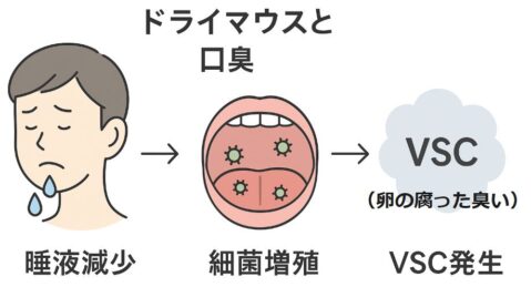 ドライマウスと口臭のメカニズム図解