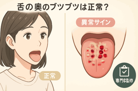 舌の奥にブツブツがある場合とない場合を比較した医療監修のアニメ風イラスト。正常な舌と異常サインがひと目でわかる画像