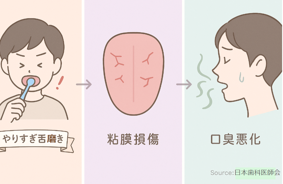 舌磨きのやりすぎ→粘膜損傷→口臭悪化を示すフロー図解