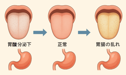 胃酸分泌と舌苔の変化を示す図解