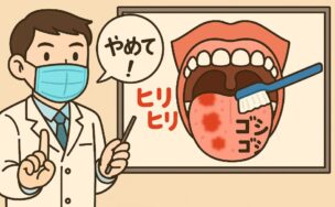 舌磨きのリスクを説明する歯科医医師
