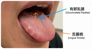 有郭乳頭(舌奥のぶつぶつ)の写真図解