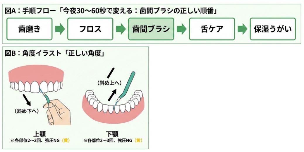 歯間ブラシを使った口臭対策の図解。歯磨きから保湿までの正しい手順フロー、上顎(斜め下)と下顎(斜め上)への挿入角度、隙間の広さに応じたフロスのチャート。