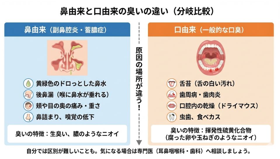 臭いの原因が「鼻(副鼻腔炎・蓄膿症)」か「口(一般的な口臭)」かを判別するための比較図。鼻由来の特徴(黄緑色の鼻水、後鼻漏、頬の痛み)と、口由来の特徴(舌苔、歯周病、乾燥)を2カラムで分かりやすく解説。
