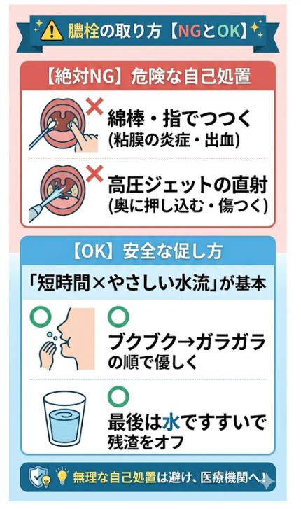 膿栓のやってはいけない取り方（綿棒・高圧洗浄）と安全なうがい法
