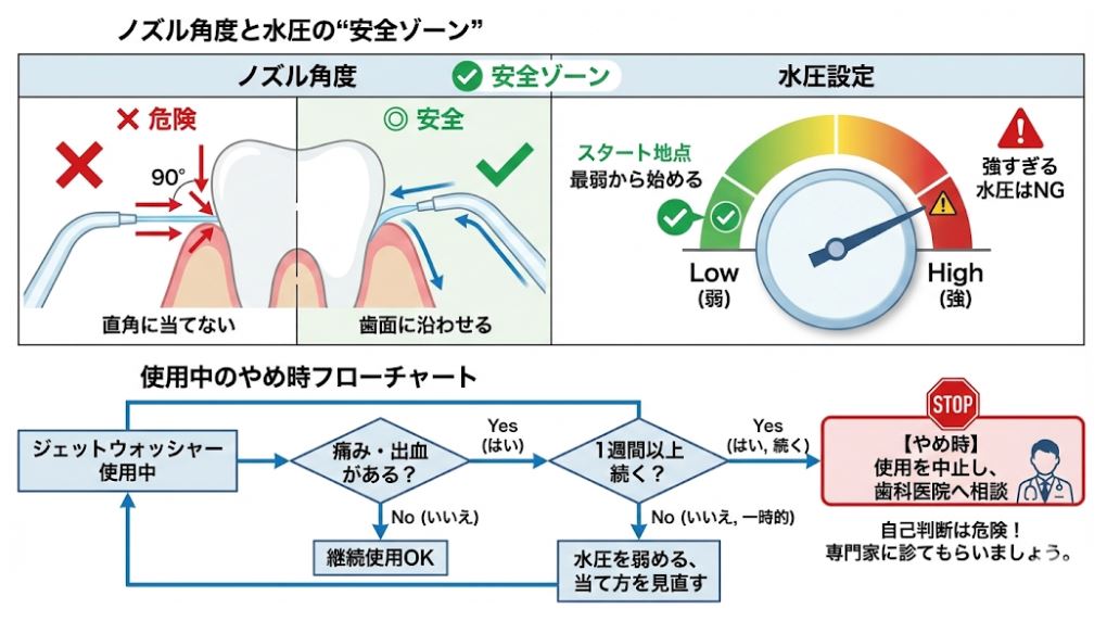 ジェットウォッシャーの正しいノズル角度(歯面に沿わせる)と水圧設定(弱から開始)の解説、および痛みや出血が1週間以上続く場合の使用中止フローチャート。
