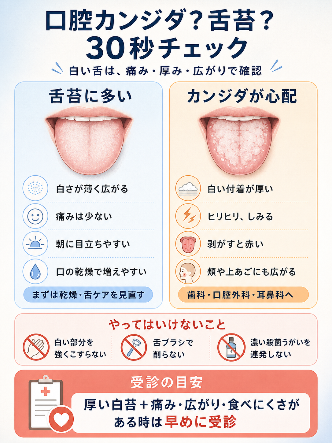 口腔カンジダと舌苔の違いを白苔の厚み、痛み、剥がした時の赤み、受診目安で比較する30秒チェック図解