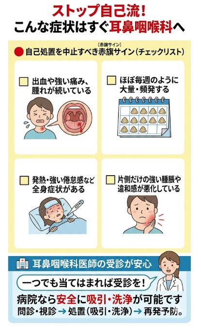 膿栓の自己処置を中止すべき赤旗サイン（出血・痛み・頻発など）と耳鼻咽喉科への受診目安
