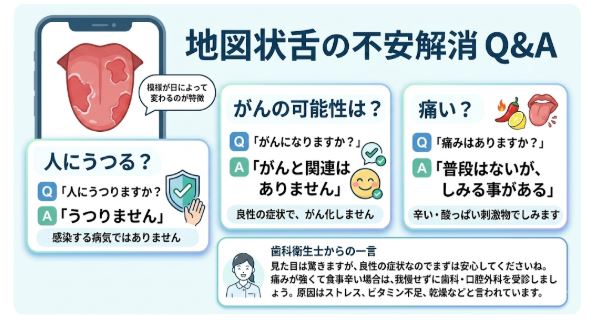 地図状舌の特徴と3大不安(人にうつるか・がんの可能性・痛みの有無)の図解