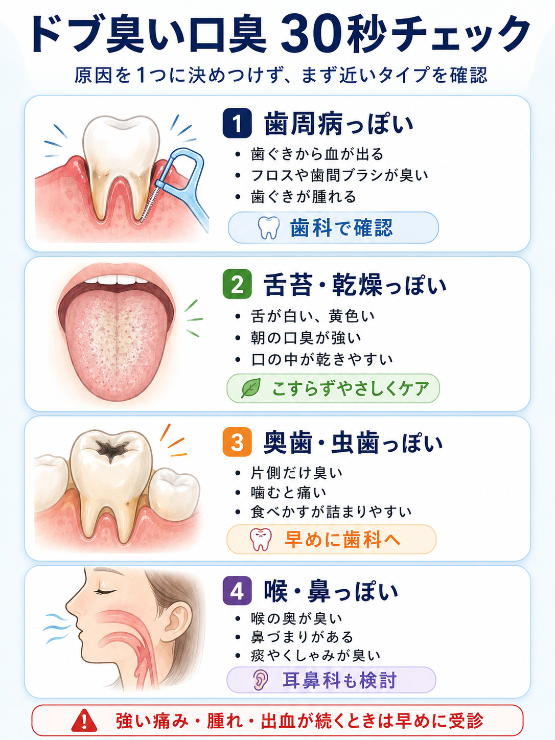 ドブ臭い口臭の原因を歯周病、舌苔、奥歯、喉鼻の4タイプで見分ける30秒セルフチェック図解