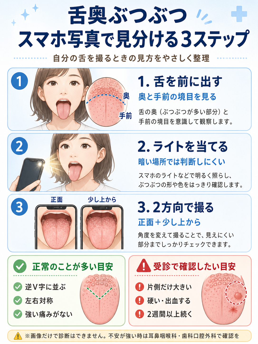 舌の奥のぶつぶつをスマホ写真で見分ける方法。舌を前に出す、ライトを当てる、正面と少し上から撮る3ステップと、受診目安を示した図解