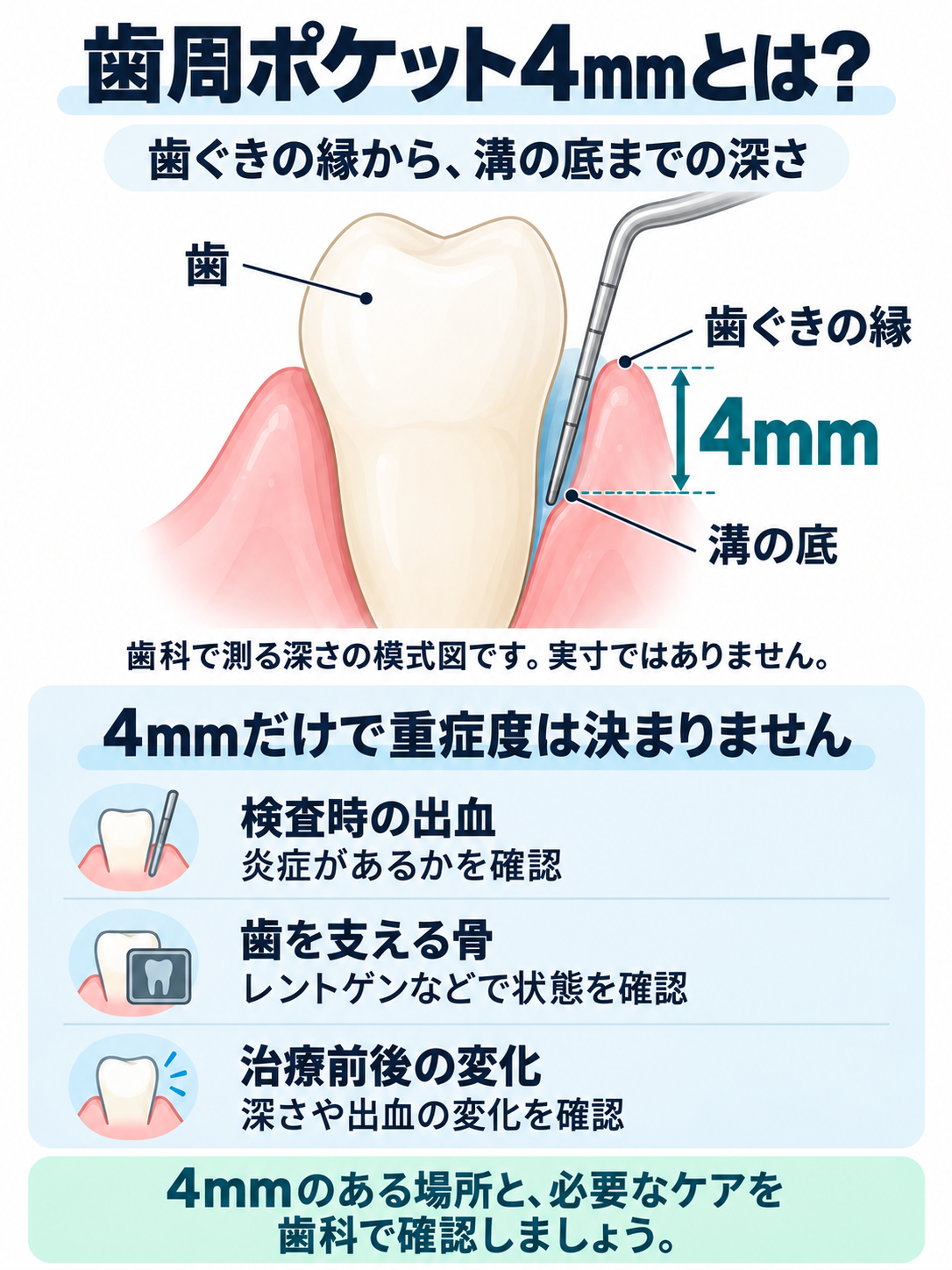 歯ぐきの縁から溝の底までの4mmの測定位置と、出血・骨の状態・治療前後の変化を確認することを示す図